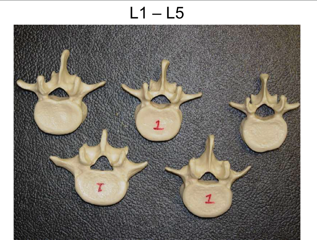 <p>Lumbar Vertebrae <strong>Types of vertebrae</strong></p>