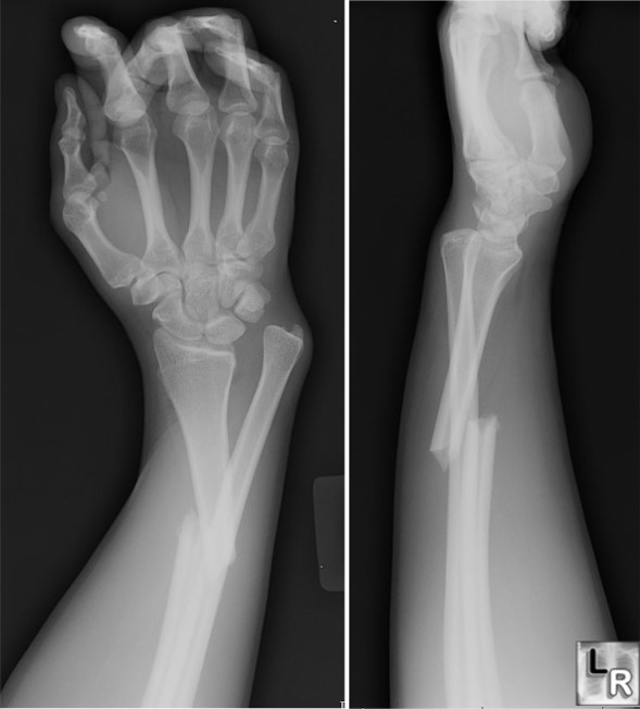 <p>What is the diagnosis?</p>