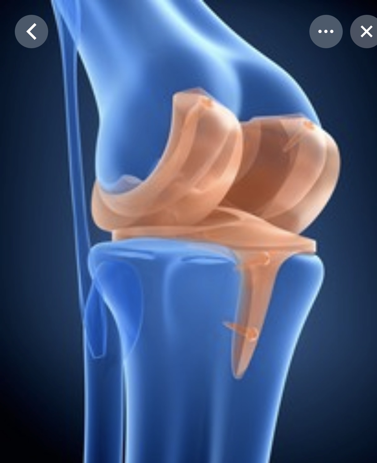 <p>Hinge joint</p>