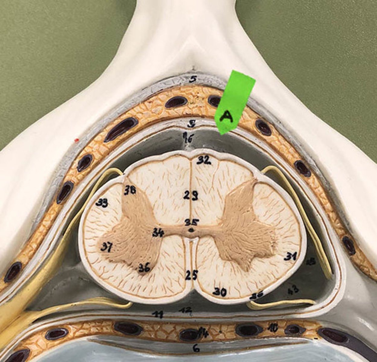 <p>Identify this layer of meninges.</p>