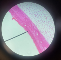 <p>Location: <span style="background-color: transparent;">Lining of the trachea and parts of the upper respiratory tract</span></p><p><span style="background-color: transparent;">Function: Protects & secretes mucus</span></p><p><span style="background-color: transparent;">Epithelial Tissue</span></p>