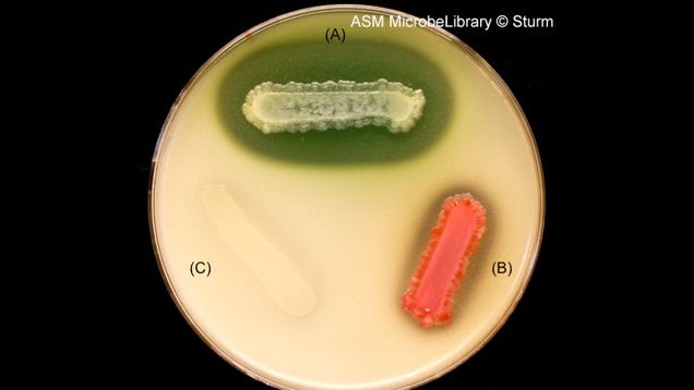<p>What is broken down in the Casein agar media? What type of macromolecule is it? </p>