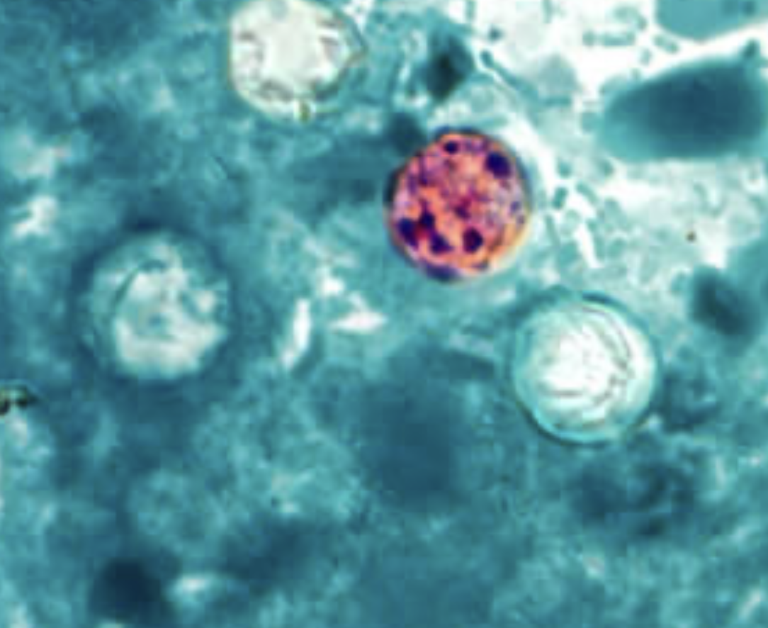 <p>What parasite is this?</p>