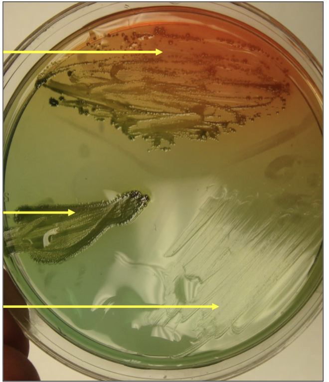 <p>what’s the ph indicator?</p>