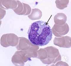 <p>Identify</p>