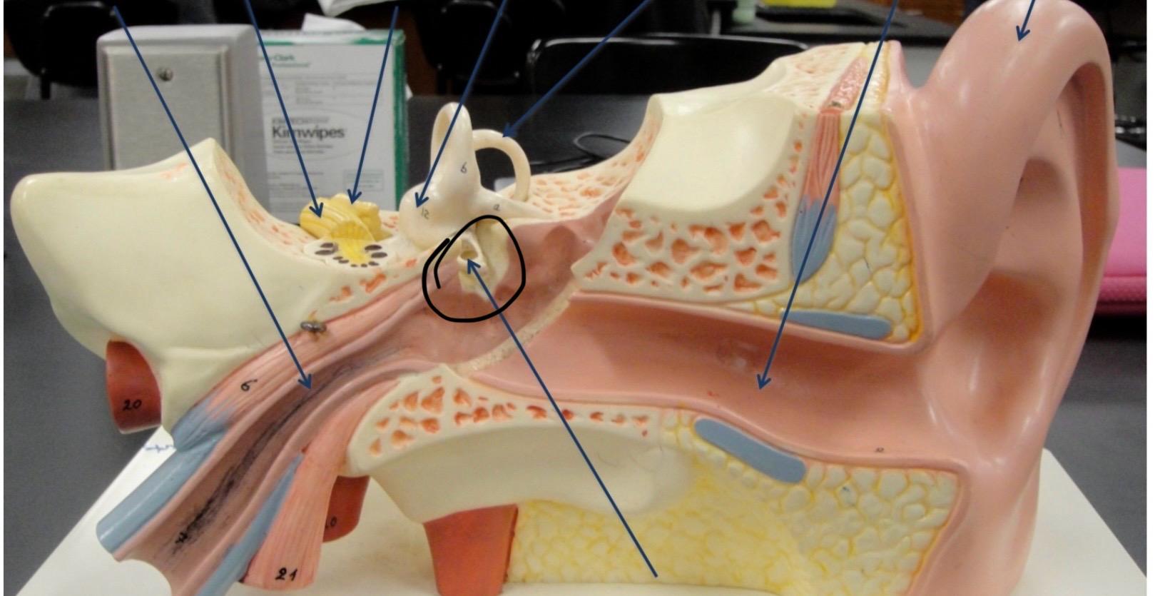 <p>Identify the circled area?</p>