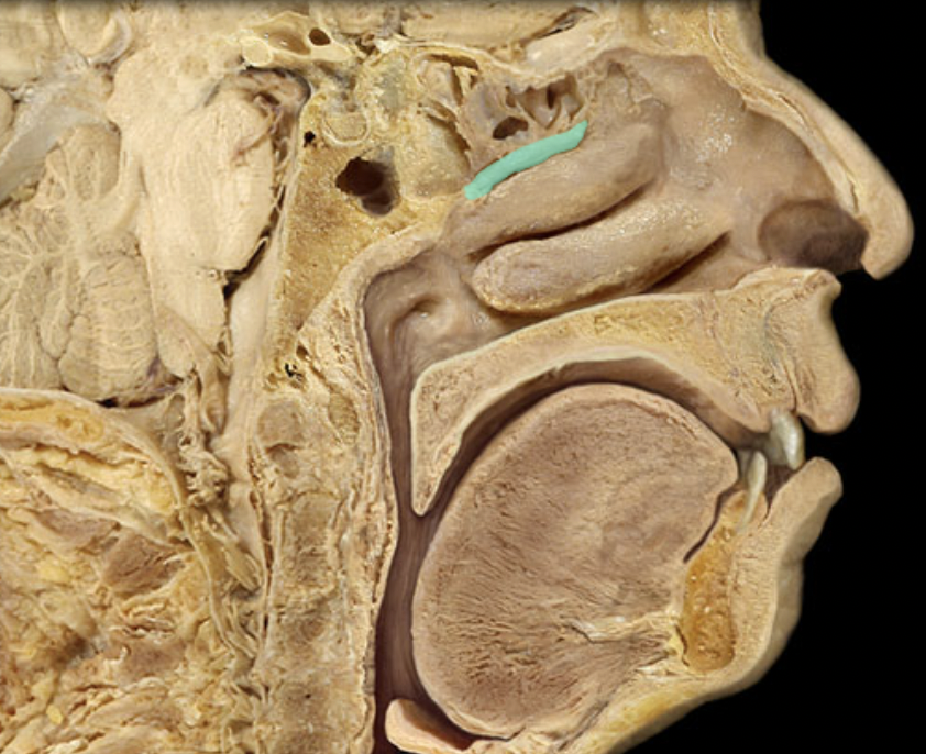 <p>Identify the feature of the nasal cavity</p>