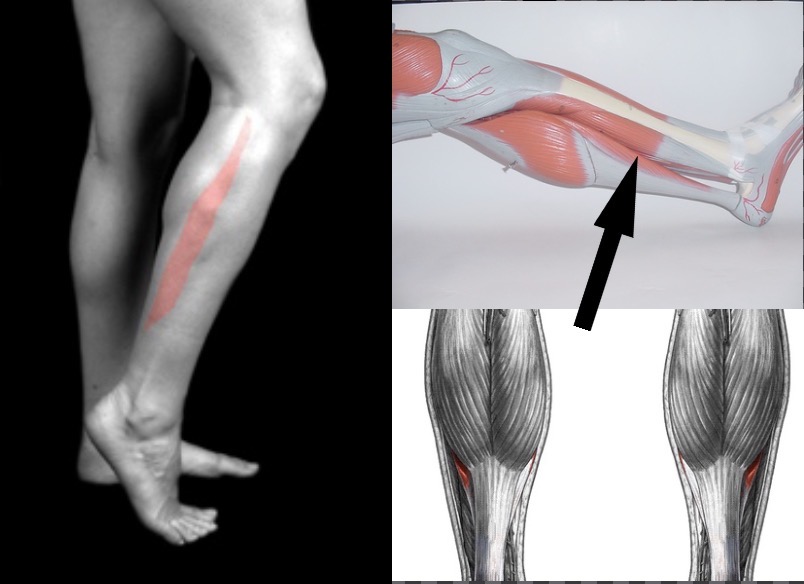 <p>What muscle is this?</p>