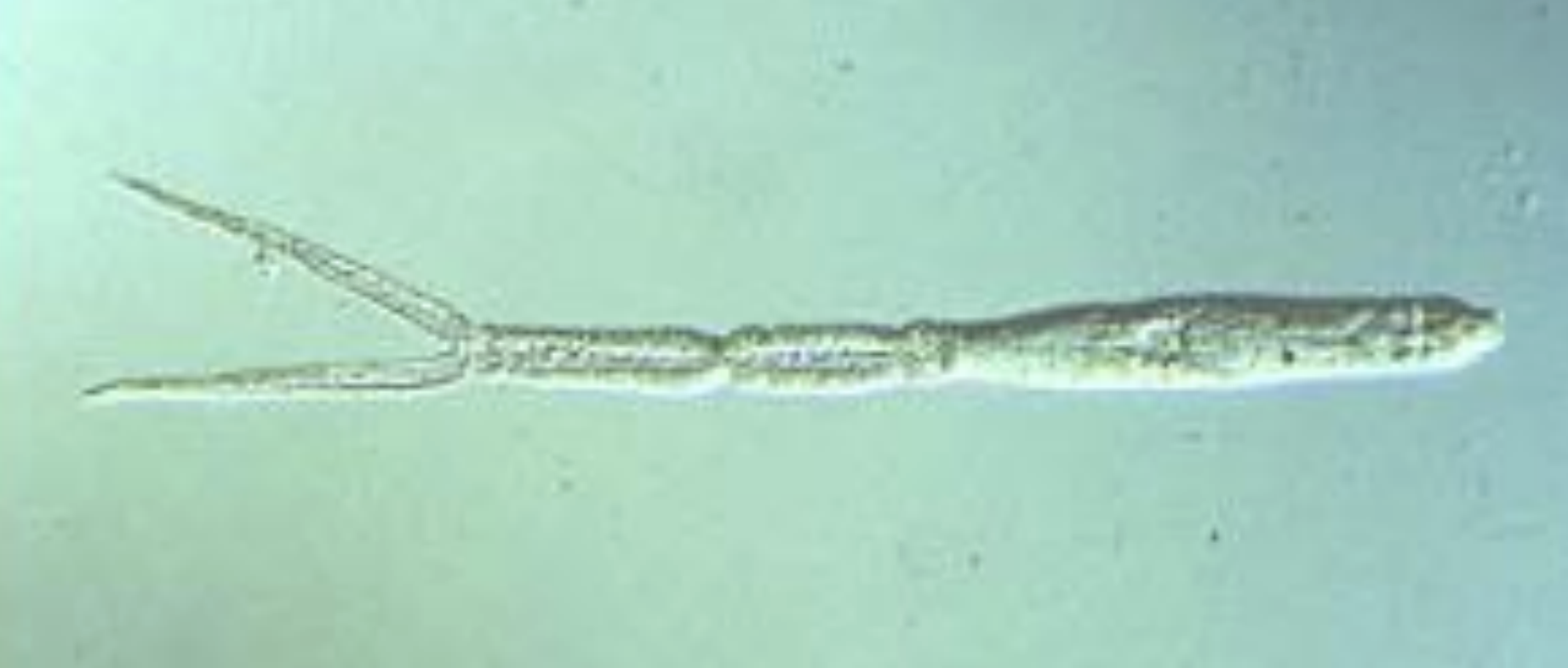 <p>what life stage is this? </p>