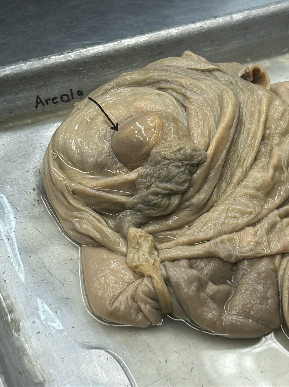 <p>Pregnant sow (diffuse placenta type) - uterus</p>