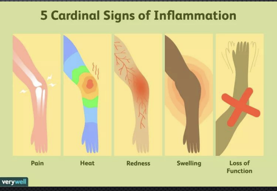 <p>Inflammation - the heat,pain, redness, and swelling aht initially or exclusively occur at site of infection</p>