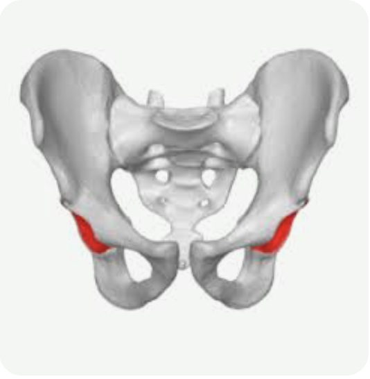 <p>Name this part of the pelvis</p>