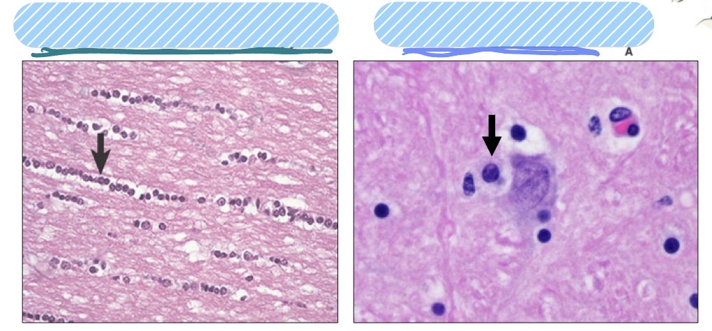 <p>What are the 2 different types of oligodendrocytes, where are they found, and what do they do?</p>