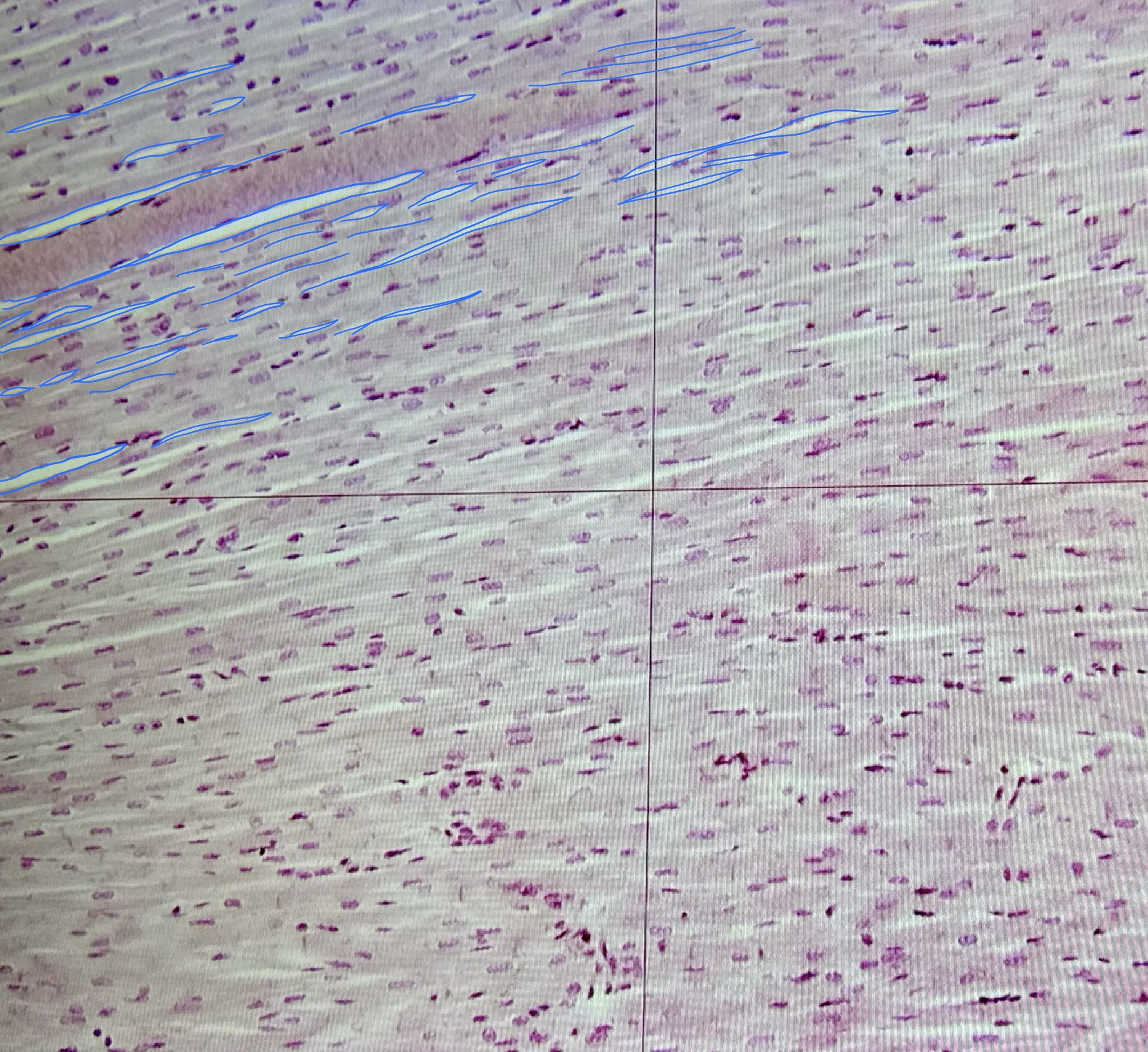 <ul><li><p><strong>a band</strong>: darker band</p></li><li><p><strong>i band</strong>: lighter band</p></li></ul><p></p>