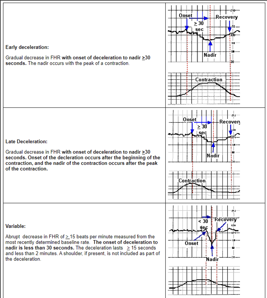 <p>Early- head compression</p><p>Late- placental insufficiency</p><p>Variable- cord compression</p><p></p><p>Variable must be 15 beats below the baseline, early/late is only 10 beasts below baseline.</p><ul><li><p>Early decels are good ones</p></li><li><p>Variable decels as bad ones </p></li><li><p>Late decels are ugly never want to see them</p></li></ul><p></p>