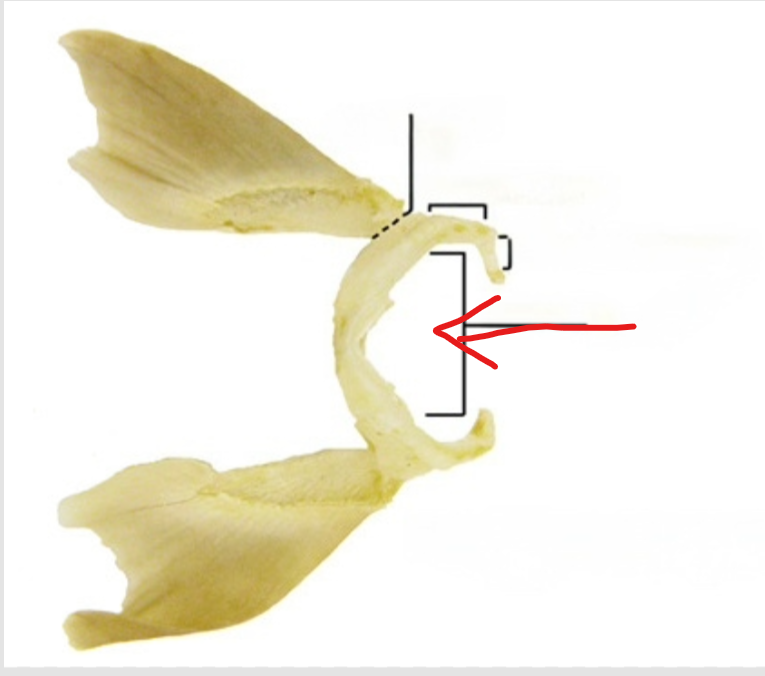 <p>The ventral portion of the U-shaped scapulocoracoid bar</p>