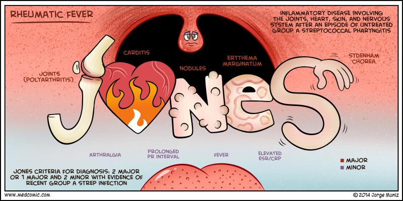 <p>Major Criteria — J<span data-name="hearts" data-type="emoji">♥</span>NES </p><ul><li><p><strong>J</strong> = <strong>Joints</strong> → migratory polyarthritis</p></li><li><p><span data-name="hearts" data-type="emoji">♥</span> = <strong>Carditis</strong> → especially <strong>mitral valve</strong> involvement</p></li><li><p><strong>N</strong> = <strong>Nodules</strong> → subcutaneous nodules</p></li><li><p><strong>E</strong> = <strong>Erythema marginatum</strong></p></li><li><p><strong>S</strong> = <strong>Sydenham chorea</strong></p></li></ul><p> Minor Criteria </p><ul><li><p><strong>Fever</strong></p></li><li><p><strong>Arthralgia</strong></p></li><li><p>↑ <strong>ESR/CRP</strong></p></li><li><p><strong>Prolonged PR interval</strong> on ECG</p><div data-type="horizontalRule"><hr></div><p><strong>2 major</strong><br><strong>OR</strong><br><strong>1 major + 2 minor</strong></p></li></ul><p></p>