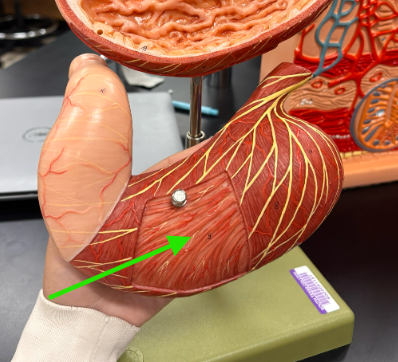 <p>What is the arrow pointing at?</p>