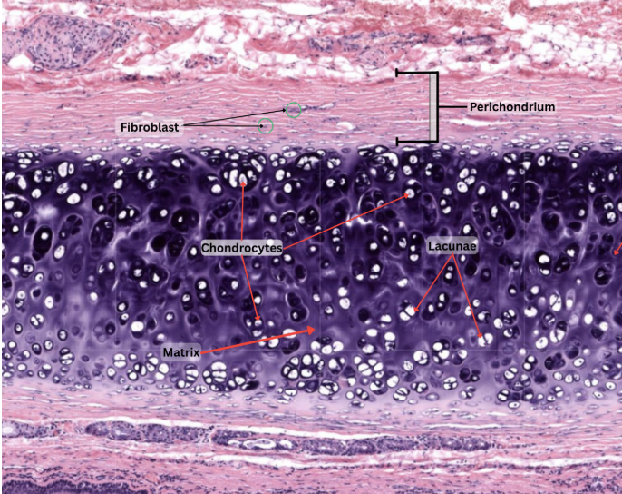 <p><span style="background-color: transparent;"><strong>HYALINE CARTILAGE</strong></span></p>
