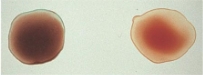 <p>What type of blood is this?</p>