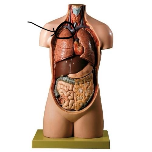 term image