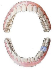 <p>mandibular left first molar</p>