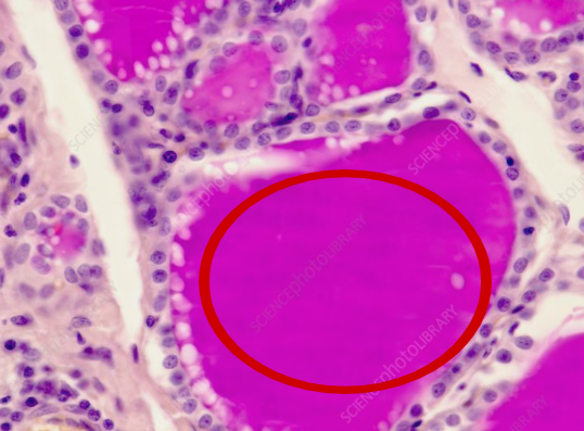 <p>What is the Red Circle pointing to? What part of the thyroid is this?</p>