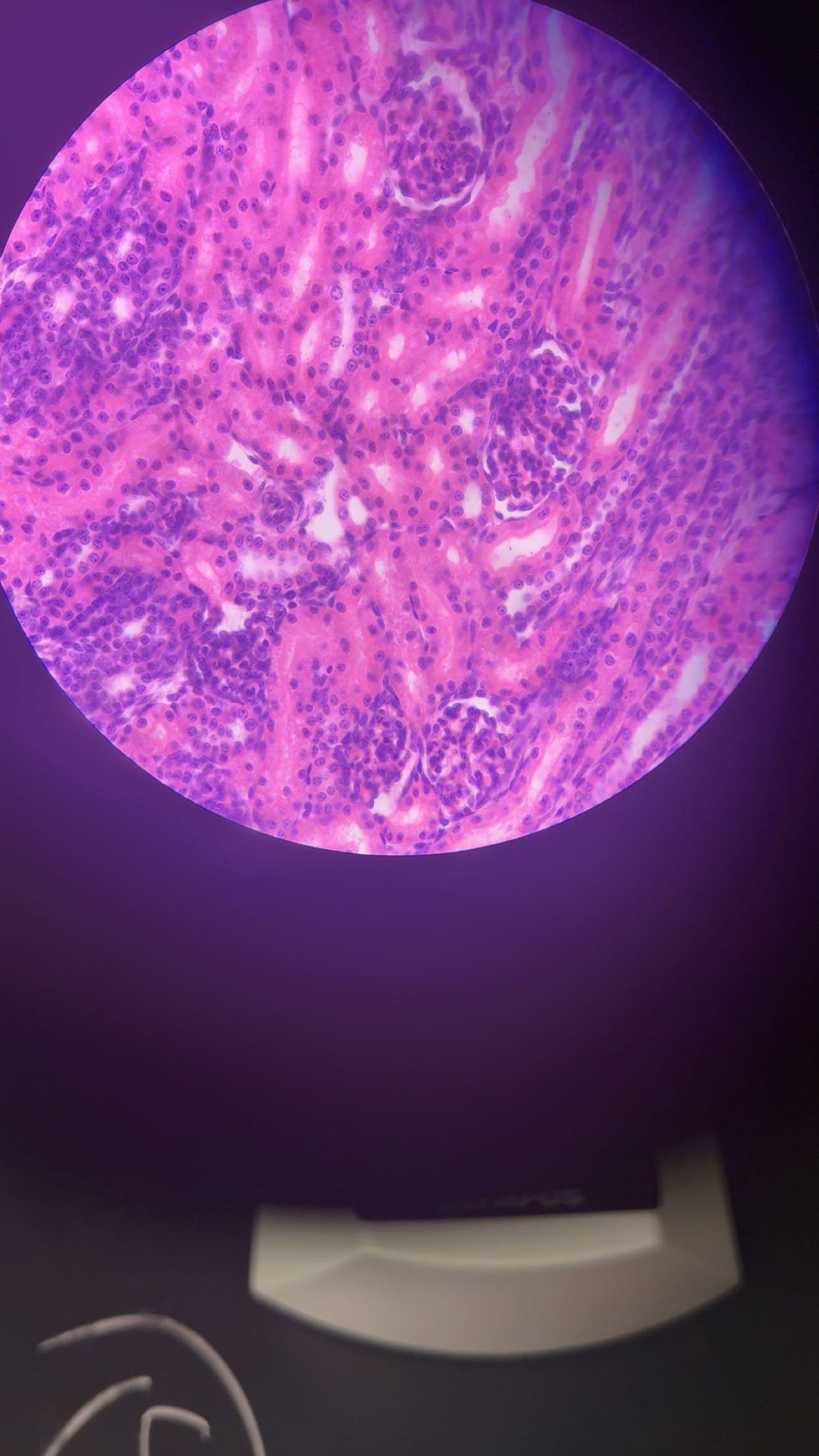 term image