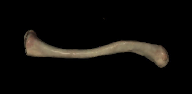 <p>Is this superior or inferior on <strong>left</strong> clavicle?</p>