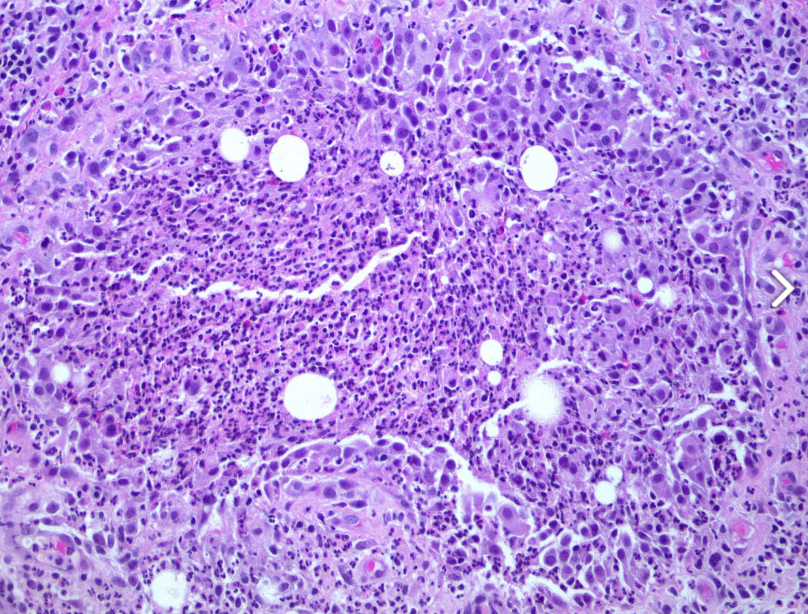 <p>Diagnostic</p>