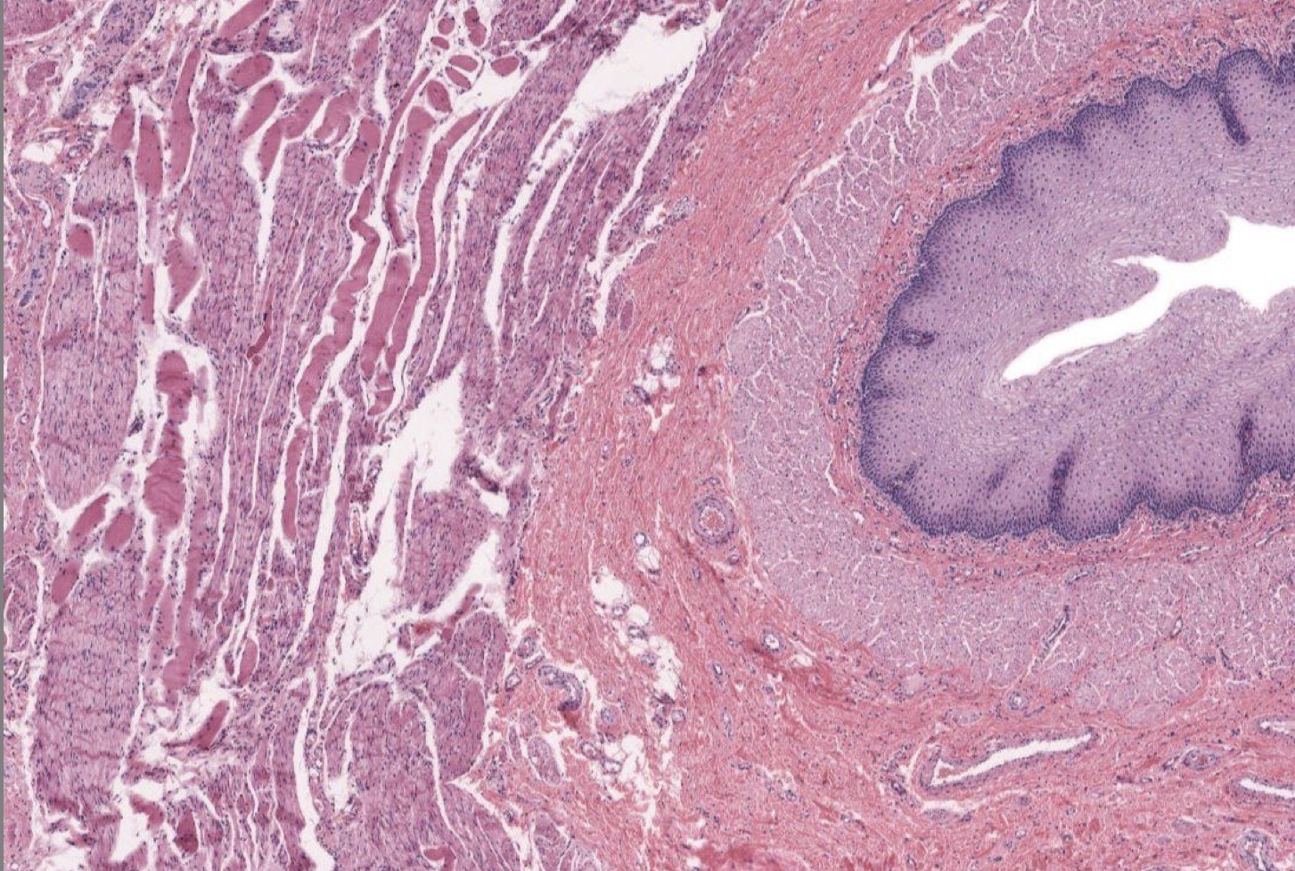 <p>Identify the Layers of the Esophagus</p>