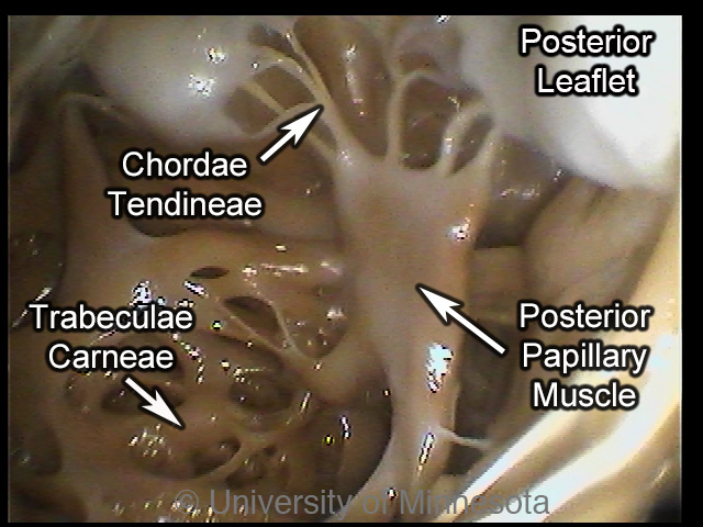 <p>raised bundles of cardiac muscle fibers; in the right ventricle</p>