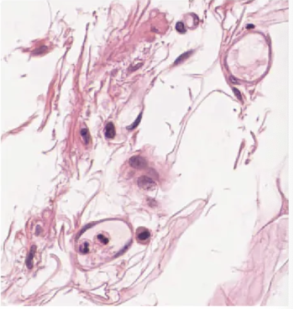 <p>connective tissue</p>