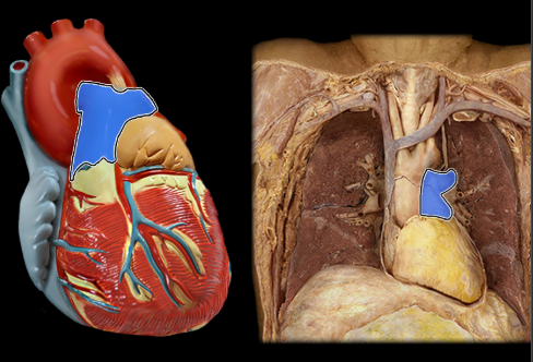 <p>blood runs from the right ventricle into here</p>