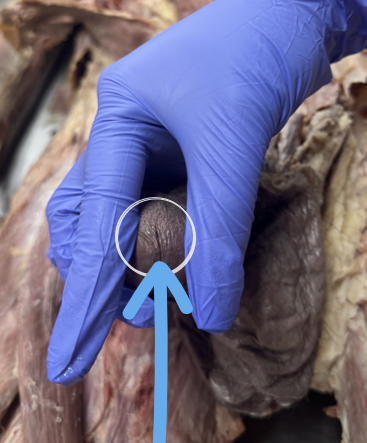 <p>external urethral orifice</p>