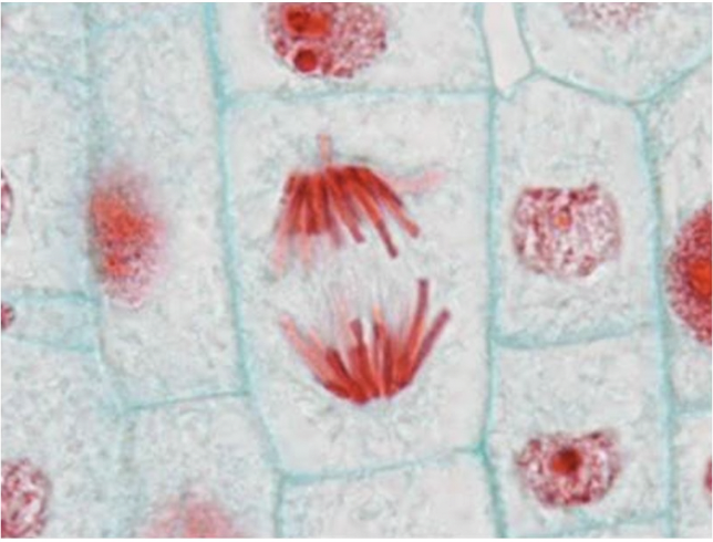 <p><span>Identify the stage of mitosis seen here in the center of the photo</span></p>