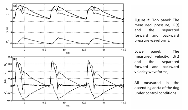 <p>integrating the changes in velocity equations to obtain the velocity waveforms in the + and - backward direction</p>