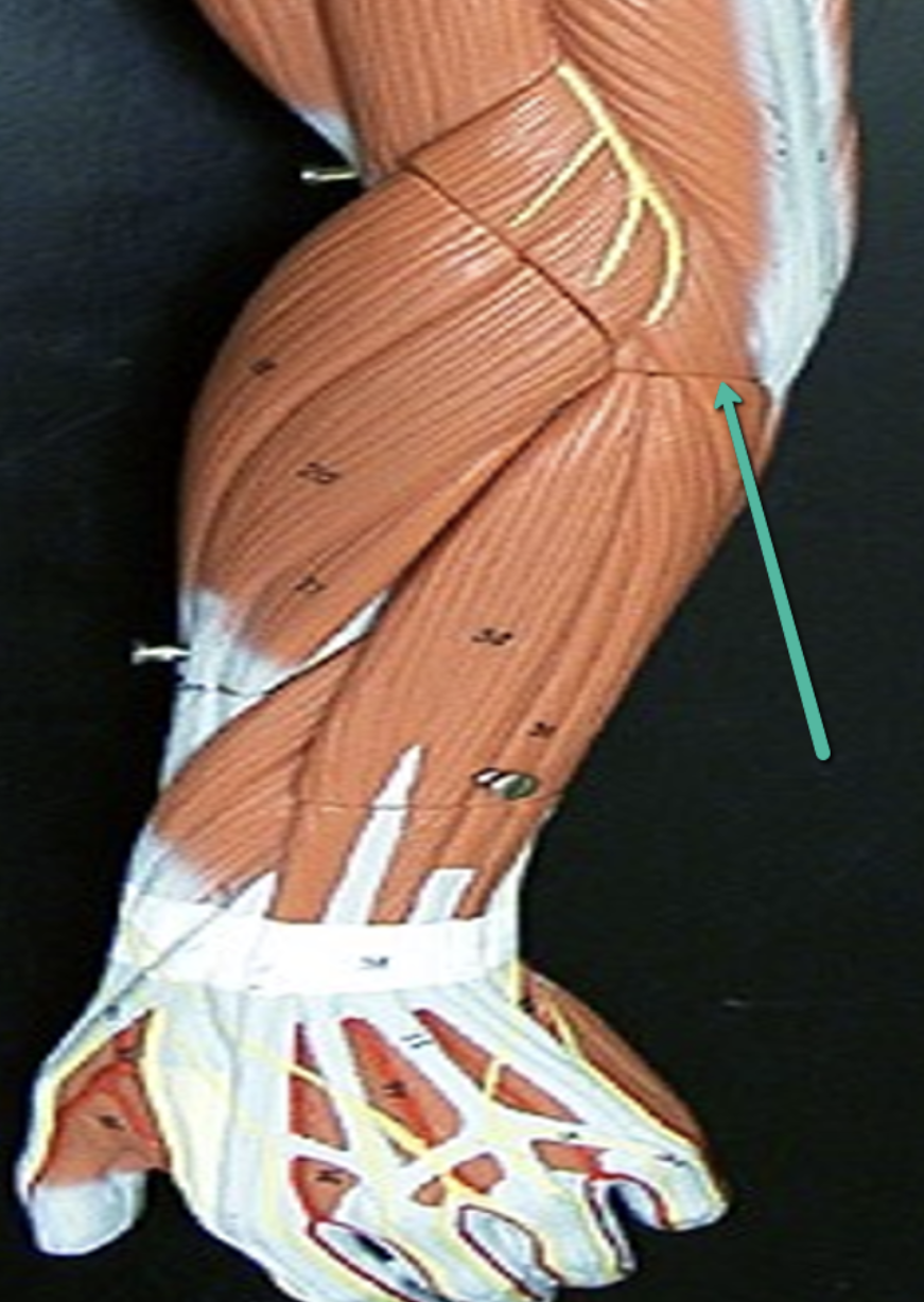 <p><strong>Arm and Shoulder Muscle Identification Practice Quiz</strong></p><p>Identify the muscle indicated by the pointer.</p>