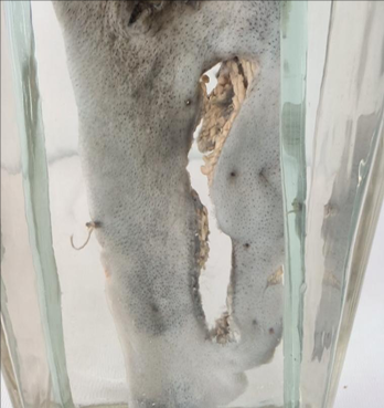 <p>Questions</p><ol><li><p>What is the specimen being examined?</p></li><li><p>What are the descriptive features of the injury on the skin?</p></li><li><p>What is the likely causative instrument for this type of injury?</p></li><li><p>How is the time of death estimated in relation to the injury and medical intervention?</p></li><li><p>What are the possible causes of death?</p></li><li><p>What is the final diagnosis for this specimen?</p></li></ol><div data-type="horizontalRule"><hr></div><p></p>