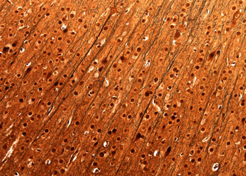 <p>Identify this tissue:</p>