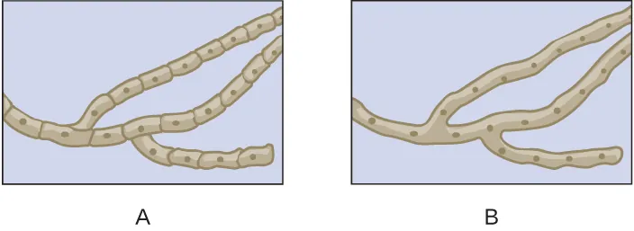 <p><br>Which of the drawings shows septate hyphae?</p>