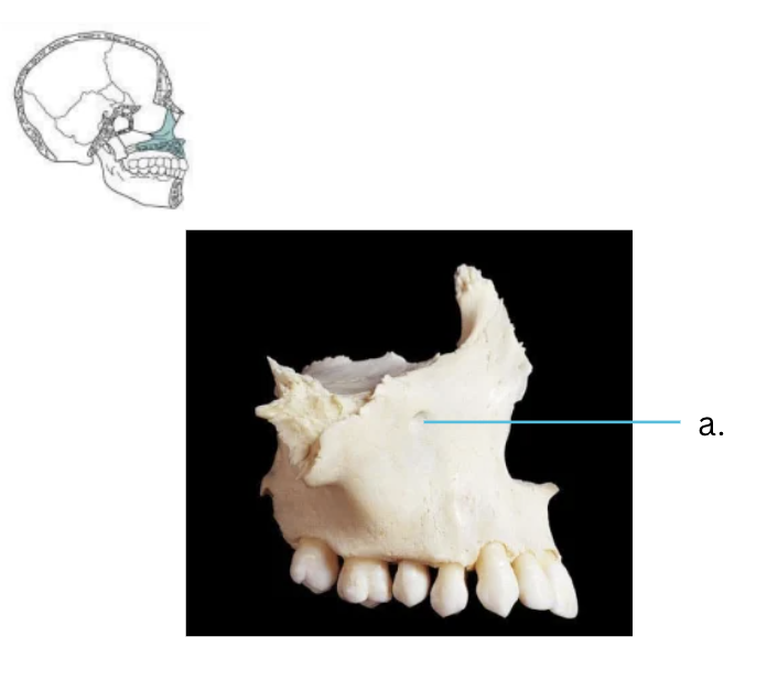 <p>Bone:</p><p>Maxilla Bone</p><p></p><p>Structure:</p><p>Infraorbital foramen (opening below eye)</p>