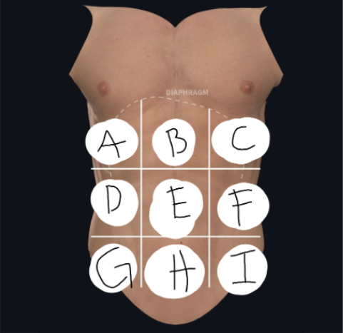 <p>What region is E</p>