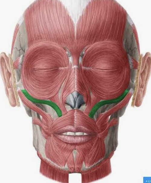 <p>Which muscle is this?</p>