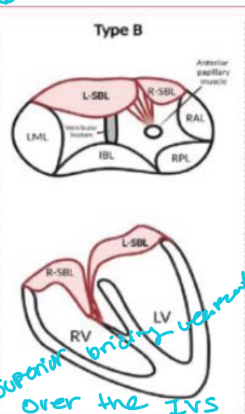 <p>The superior bridging leaflet is:</p><ol><li><p>Partially divided</p></li><li><p>Not attached directly to the septum</p></li><li><p>Connected by chordae from superior bridging leaflet to an RV papillary muscle near the septum</p></li></ol><p></p>