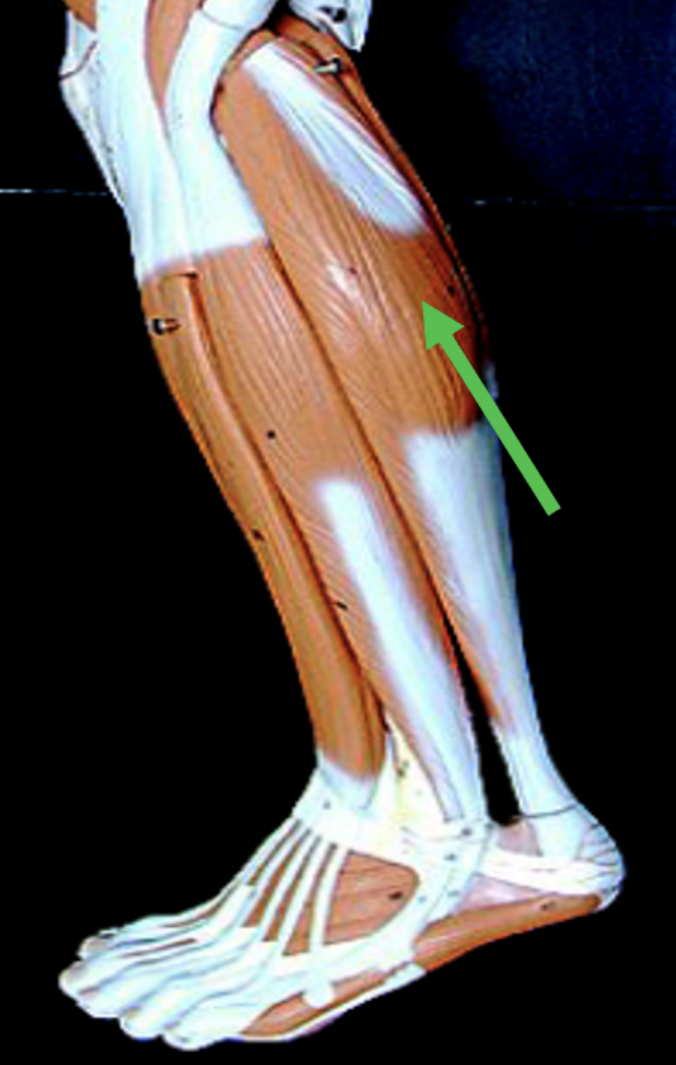 <p>Identify the muscle indicated by the pointer.</p>