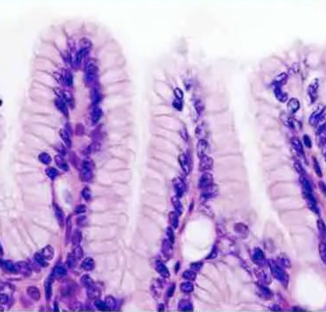 <p>What tissue is this?</p>