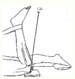 <p>The projection of the patella demonstrated in the figure above is the:</p>
