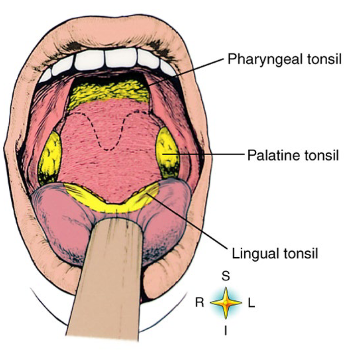 <p>Tonsils are essentially clusters of WBCs hanging out in the pharynx.</p><ul><li><p>There are 3 types:</p><ul><li><p>Pharyngeal (adenoids)</p></li><li><p>Palatine</p></li><li><p>Lingual</p></li></ul></li></ul><p></p>