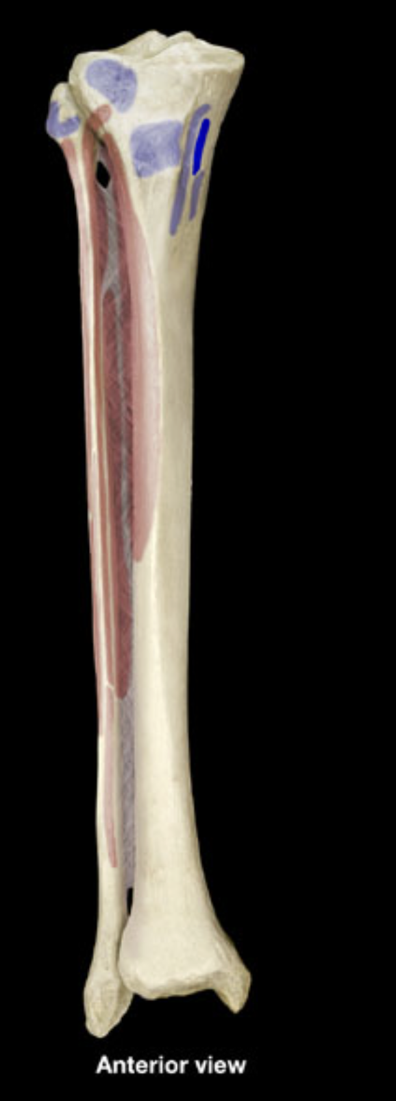 <p>proximal shaft of tibia (medial)</p>